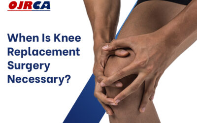 When is Knee Replacement Surgery Necessary?